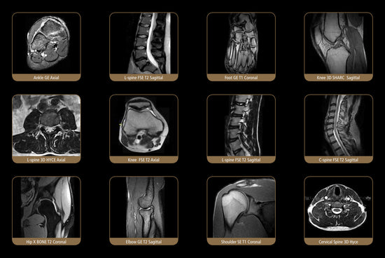 ESAOTE S-SCAN Open Dedicate MRI - 2012 WITH FARADY CAGE
