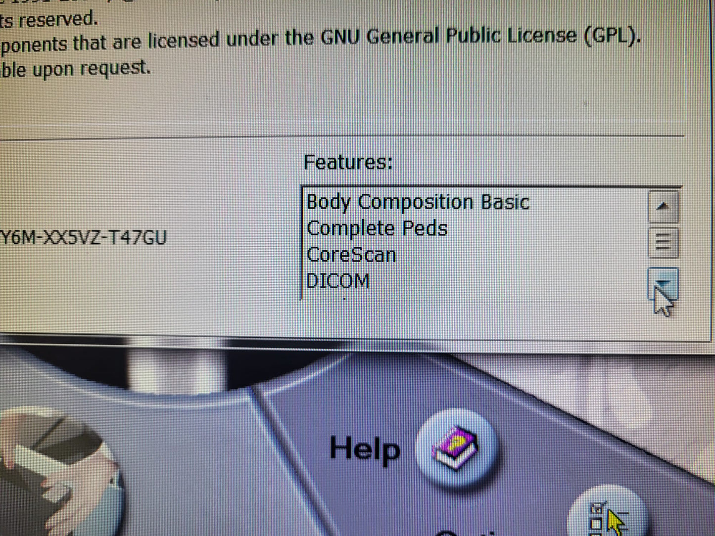 GE LUNAR iDXA Bone Densitometer – 2016