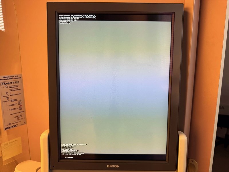 2015 Hologic Selenia Dimensions Mammography - inCAV Medical Imaging Equipment