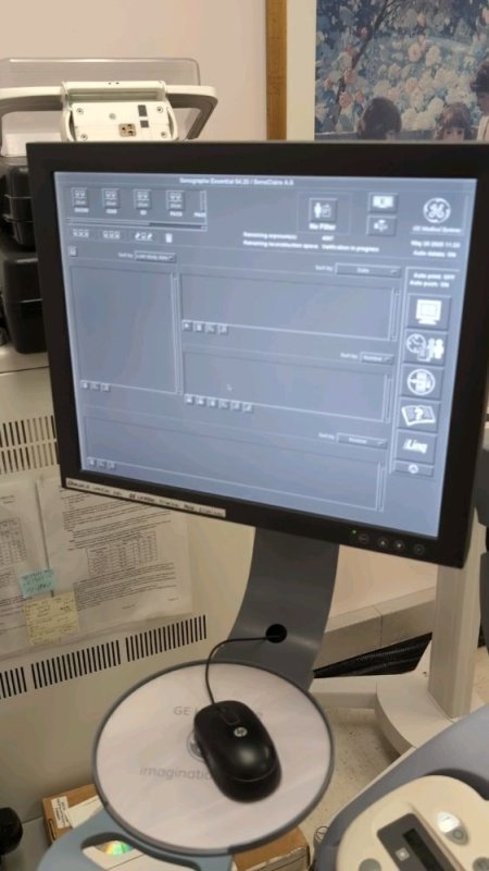 2016 GE SENOGRAPHE SENOCLAIRE 3D Mammo - inCAV Medical Imaging Equipment