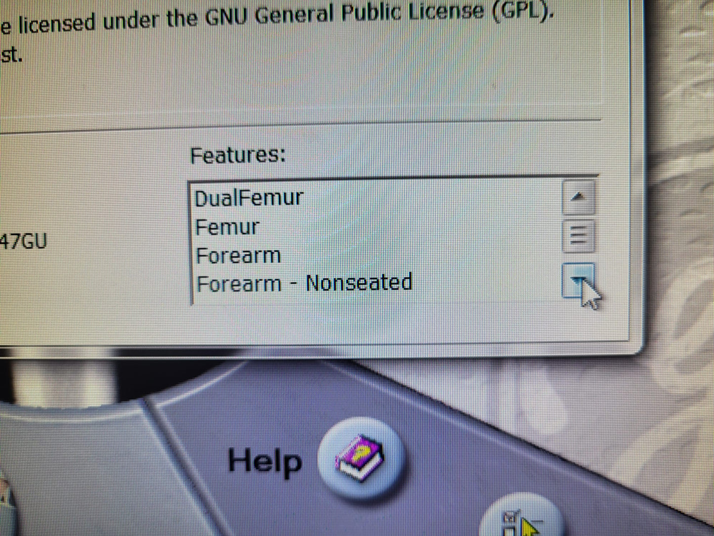 GE LUNAR iDXA Bone Densitometer – 2016