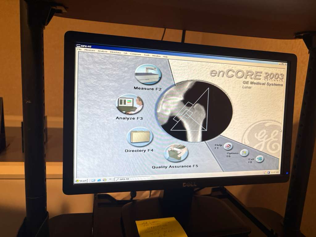 GE Lunar DPX-IQ Bone Densitometer