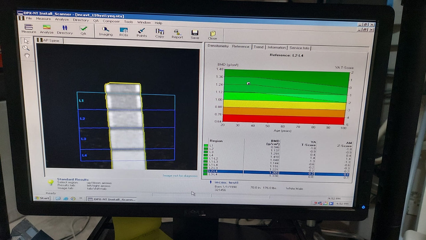 GE Lunar DPX-NT 2002
