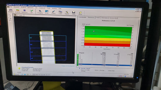 GE Lunar DPX-NT 2002