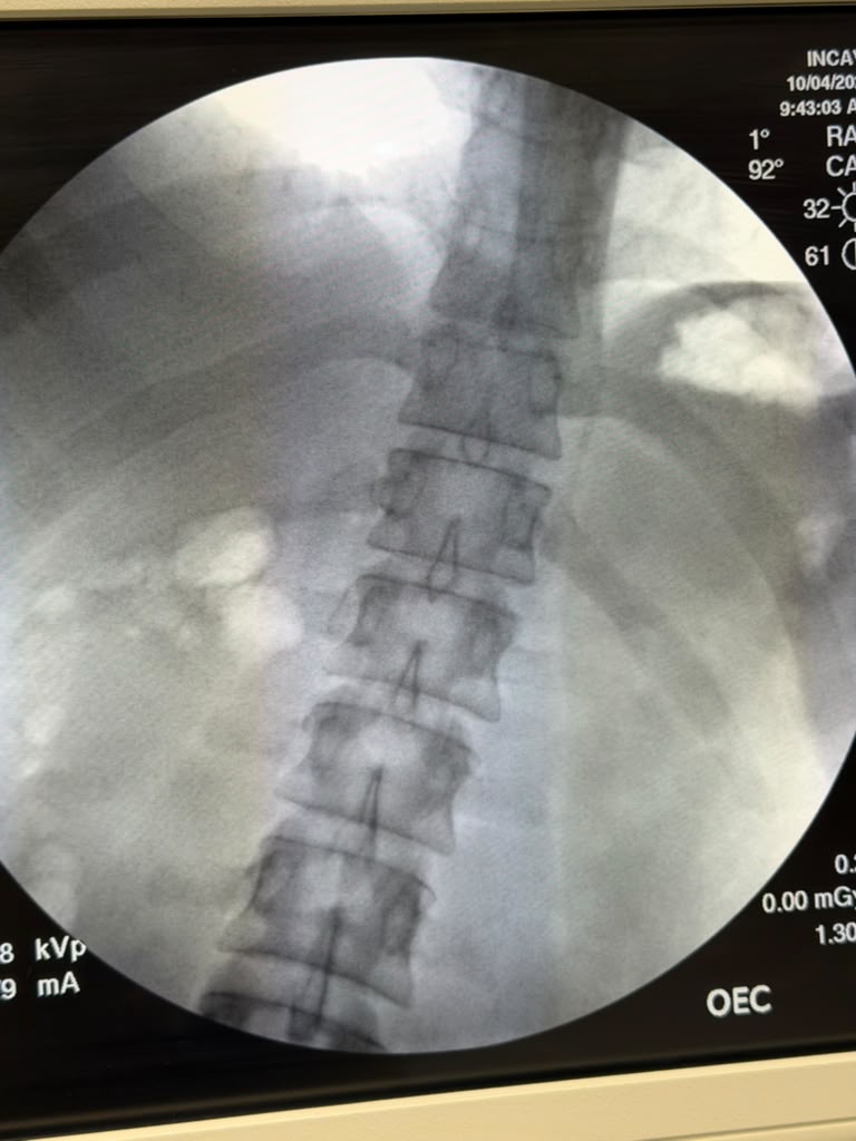 GE OEC 9900 MTS Elite Cardiac C-Arm –  2014