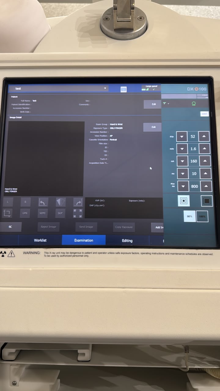Agfa DX-D 100 Mobile Digital X-Ray System