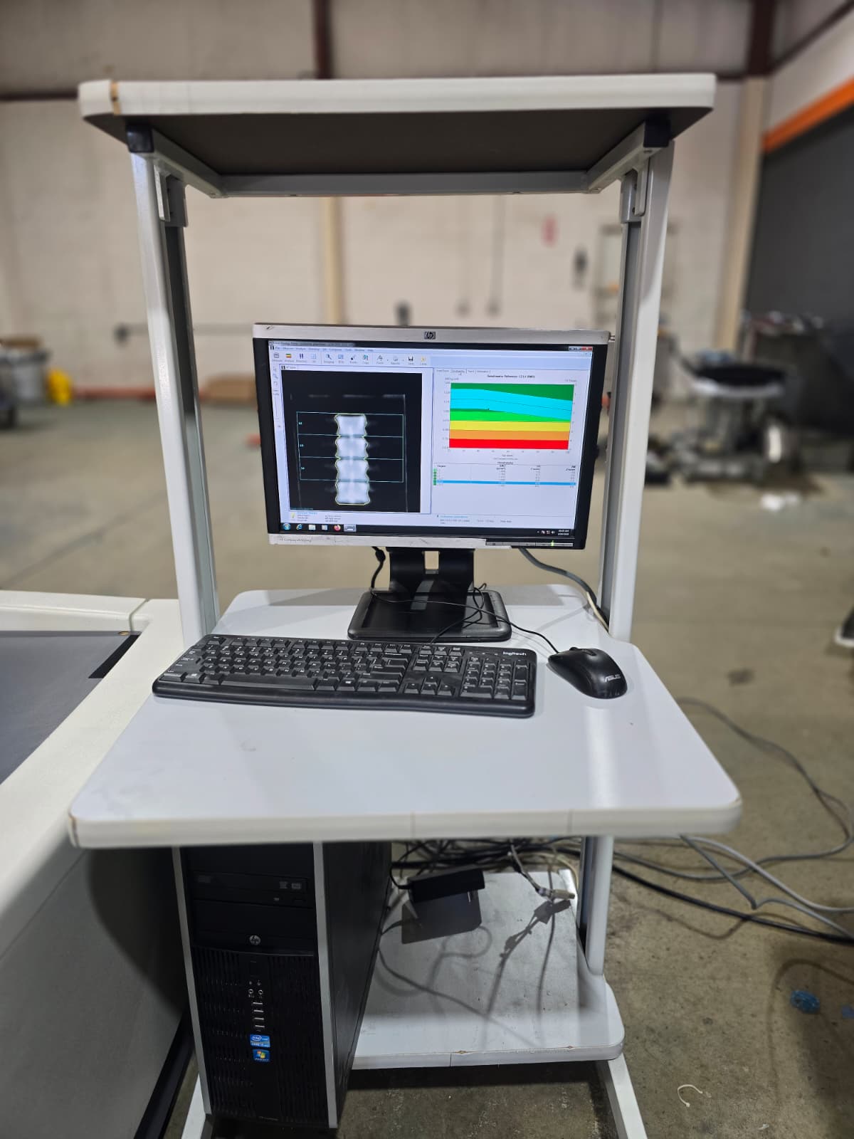 GE Lunar Prodigy Advance DXA Bone Densitometer