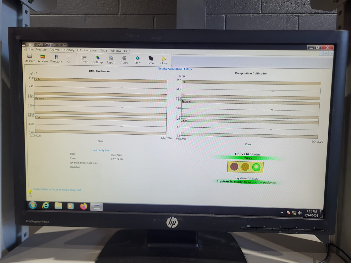 GE LUNAR iDXA Bone Densitometer – 2016