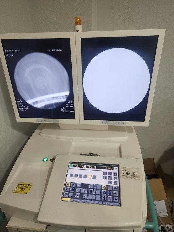 Copy of ZIEHM Vista C - arm with double monitor screen - inCAV Medical Imaging Equipment