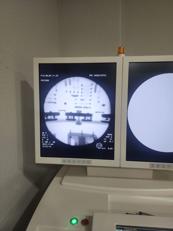 Copy of ZIEHM Vista C - arm with double monitor screen - inCAV Medical Imaging Equipment