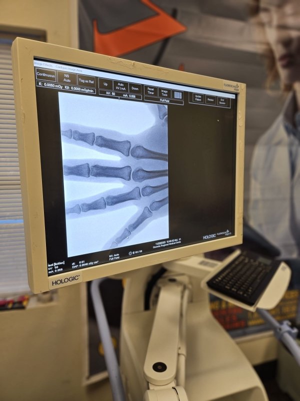 Fluoroscan Insight FD Mini C - Arm - inCAV Medical Imaging Equipment