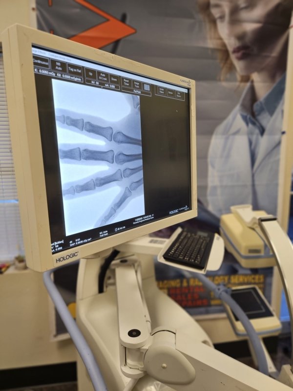 Fluoroscan Insight FD Mini C - Arm - inCAV Medical Imaging Equipment
