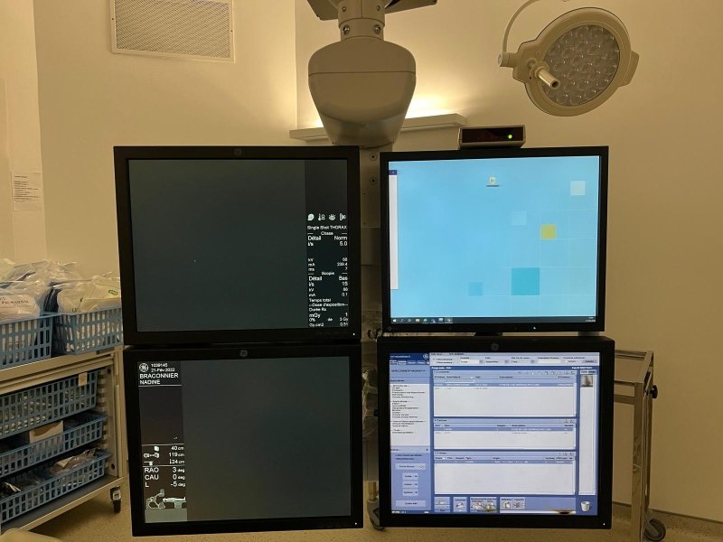 GE Innova 4100 IQ Cath Lab / Angio system - inCAV Medical Imaging Equipment