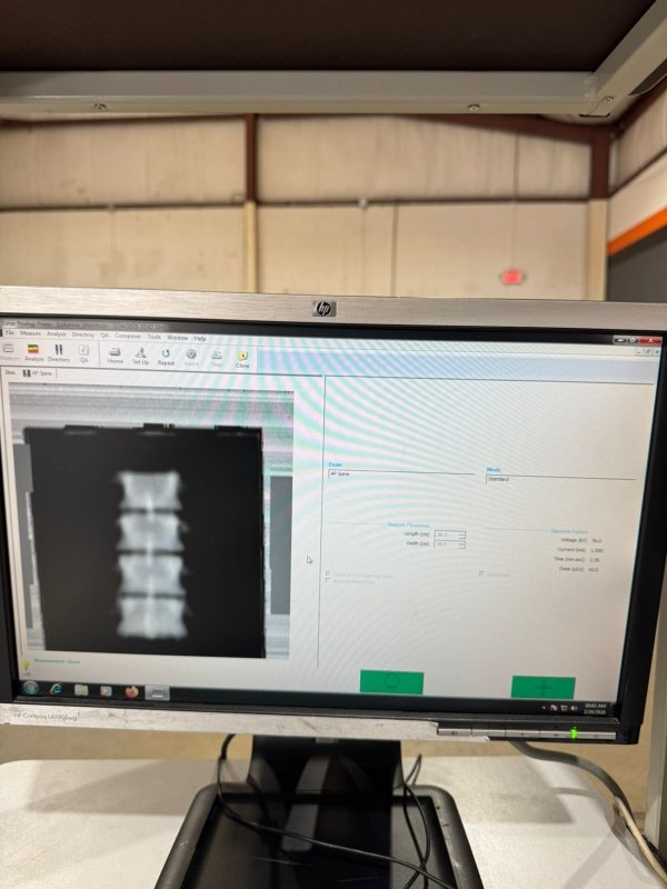 GE Lunar Prodigy Advance DXA Bone Densitometer - inCAV Medical Imaging Equipment