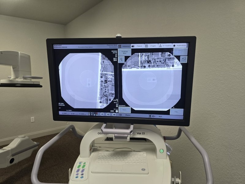 GE OEC ELITE CFD 31cm Flat Detector Super C - Arm - VAS 15 Software - inCAV Medical Imaging Equipment