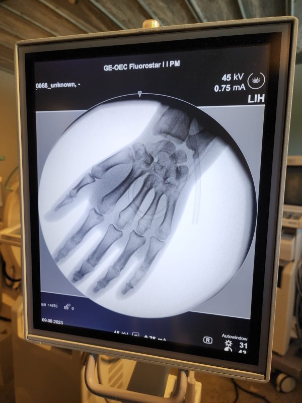 GE OEC FLUOROSTAR Compact C - ARM - inCAV Medical Imaging Equipment