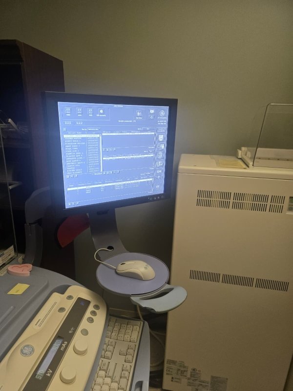 GE Senographe DS 2D Digital Mammo 2008 - inCAV Medical Imaging Equipment