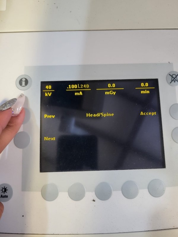 PHILIPS BV Endura 2007 - Orthpedic C - arm - inCAV Medical Imaging Equipment