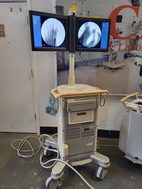 PHILIPS BV Endura 2007 - Orthpedic C - arm - inCAV Medical Imaging Equipment