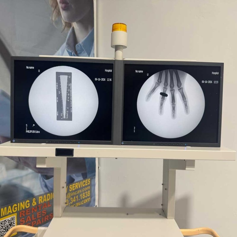 Philips BV Libra C-Arm 2008 – 9" Flat Panel Monitor System - inCAV Medical Imaging Equipment