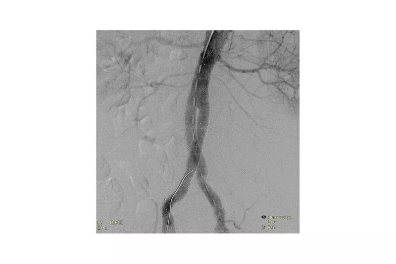 Philips Zenition 70 with Flat Detector C Arm - 2020 - inCAV Medical Imaging Equipment