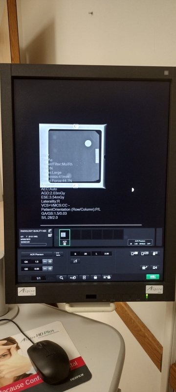 2012 Fujifilm Aspire HD Mammogram Unit - inCAV Medical Imaging Equipment