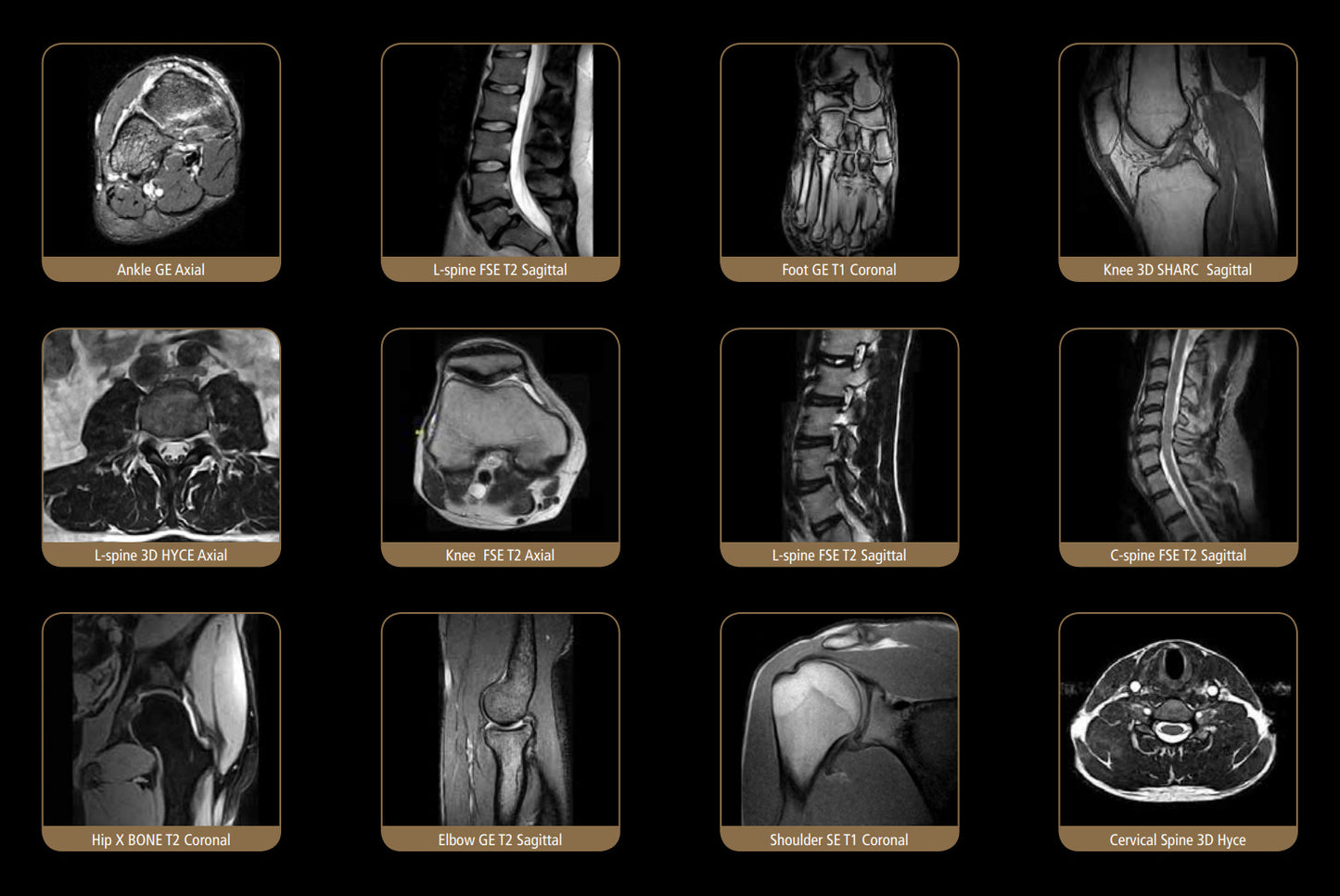 Load image into Gallery viewer, ESAOTE S-SCAN Open Dedicate MRI - 2012 WITH FARADY CAGE
