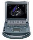 Sonosite M Turbo portable ultrasound system