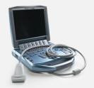 Sonosite Titan portable ultrasound system