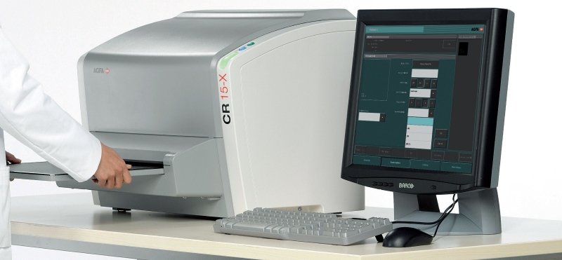 AGFA CR - 15X Digitizer - inCAV Medical Imaging Equipment