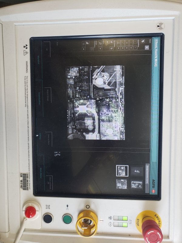 AGFA DX - D100 DIGITAL DR PORTABLE X - RAY with WIRELESS Flat Panel Detector - inCAV Medical Imaging Equipment