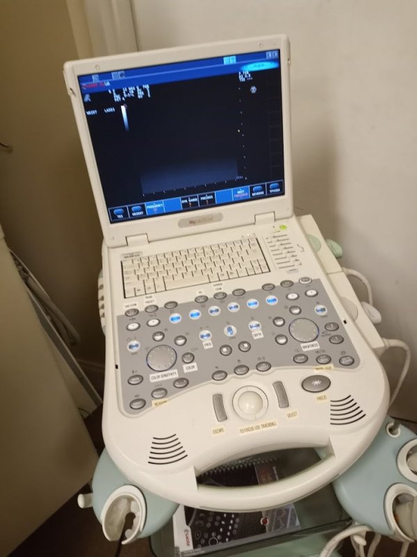 Esaote MyLab 25Gold Ultrasound Machine with 4D Volumetric and Doppler Color - inCAV Medical Imaging Equipment