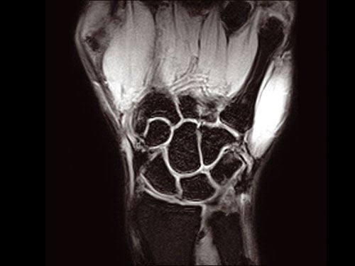 ESAOTE O - SCAN eXP 2016 - Dedicate MRI for Extremities with Cage - inCAV Medical Imaging Equipment
