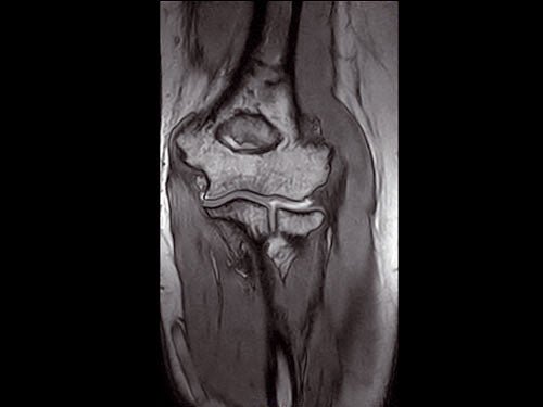 ESAOTE O - SCAN eXP 2016 - Dedicate MRI for Extremities with Cage - inCAV Medical Imaging Equipment