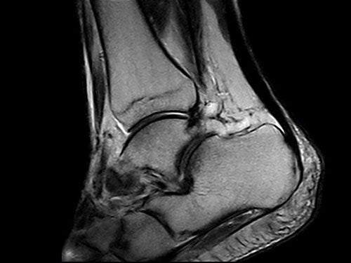 ESAOTE O - SCAN eXP 2016 - Dedicate MRI for Extremities with Cage - inCAV Medical Imaging Equipment