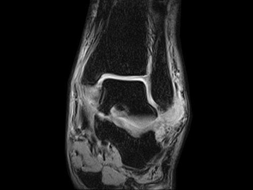 ESAOTE O - SCAN eXP 2016 - Dedicate MRI for Extremities with Cage - inCAV Medical Imaging Equipment