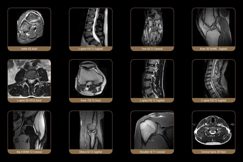 ESAOTE S - SCAN Open Dedicate MRI - 2010 WITH CAGE - inCAV Medical Imaging Equipment