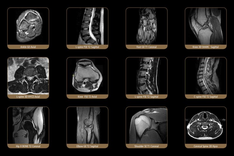 ESAOTE S - SCAN Open Dedicate MRI - 2012 WITH FARADY CAGE - inCAV Medical Imaging Equipment