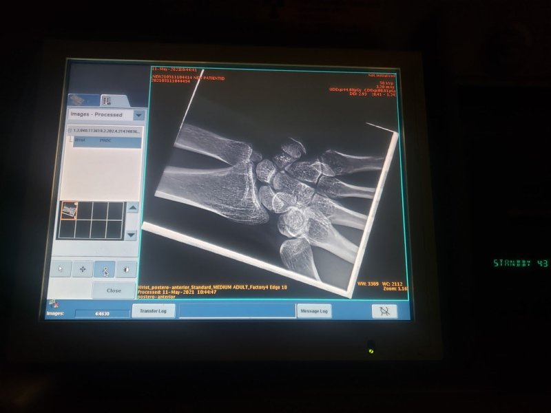 GE AMX DEFINIUM 700 Digital X - ray Portable with Flat Pannel Detector 14x17 - inCAV Medical Imaging Equipment
