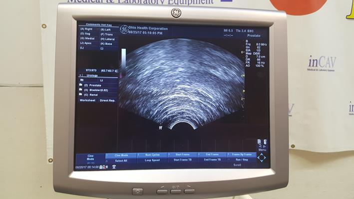GE Logiq P5 Ultrasound System with Transducers - inCAV Medical Imaging Equipment