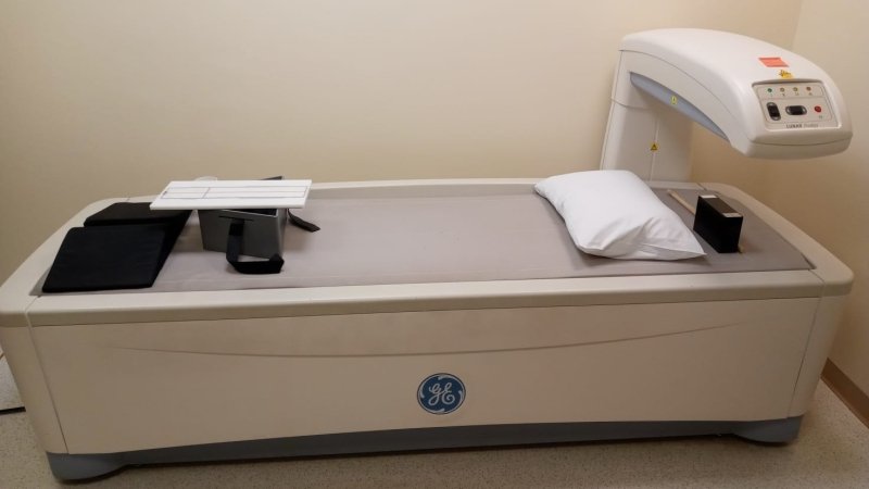 GE Lunar Prodigy 2003 Bone Densitometer - inCAV Medical Imaging Equipment