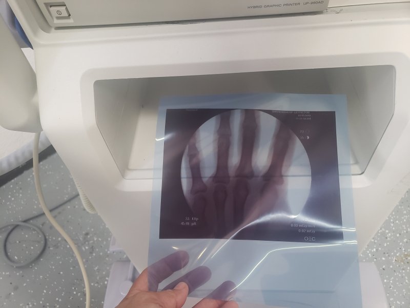 GE OEC 6800 Miniview HD C - ARM (2001) - inCAV Medical Imaging Equipment