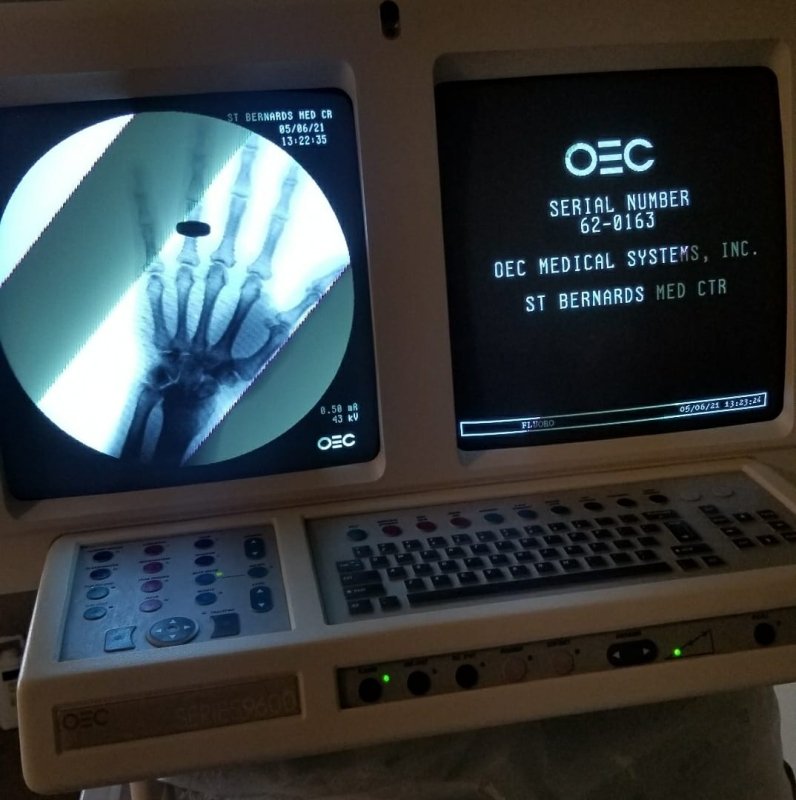 GE OEC 9600 C - ARM VASCULAR with 12 IIS - inCAV Medical Imaging Equipment