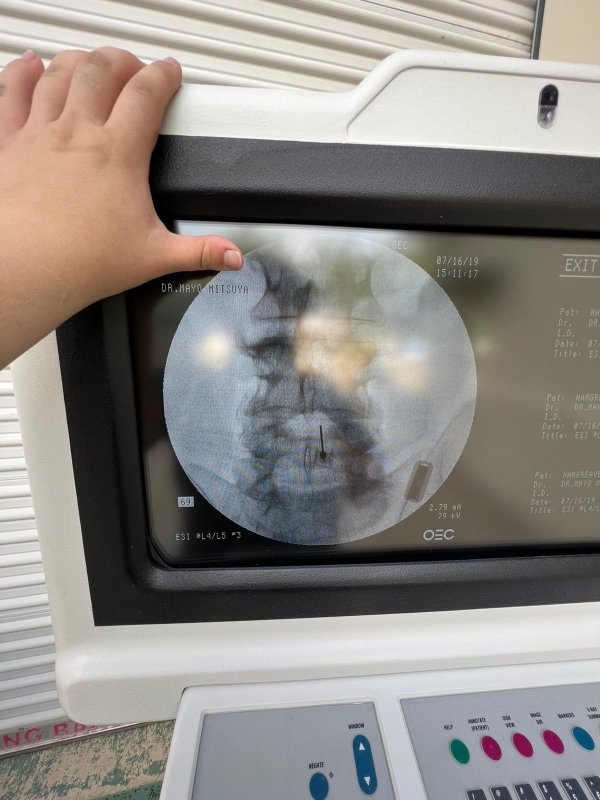 GE OEC 9600 C - Arm with Flat Panel Monitors - inCAV Medical Imaging Equipment