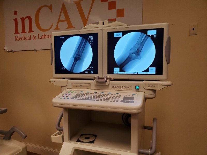 GE OEC 9900 Elite CARDIAC Motorized C - ARM 9 Inches IIS Super C - inCAV Medical Imaging Equipment