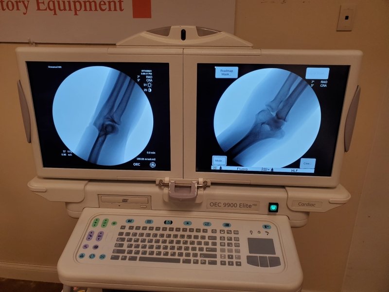 GE OEC 9900 Elite CARDIAC Motorized C - ARM 9 Inches IIS Super C - inCAV Medical Imaging Equipment