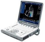 GE Vivid e Portable Ultrasound System - inCAV Medical Imaging Equipment