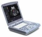 GE Voluson e Portable Ultrasound System - inCAV Medical Imaging Equipment
