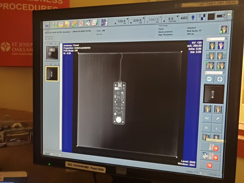 IDC Xplorer 1590 Digital Rad Room 2006 - inCAV Medical Imaging Equipment
