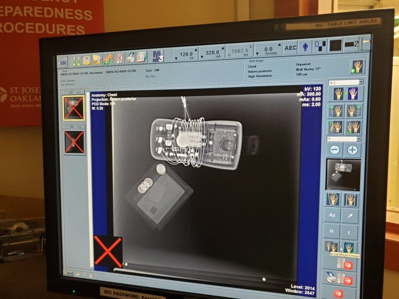 IDC Xplorer 1590 Digital Rad Room 2006 - inCAV Medical Imaging Equipment
